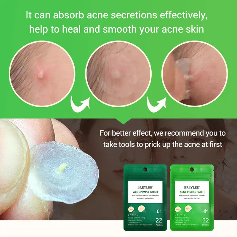 Mm Acne Pimple Patch Stickers Waterproof Acne Treatment