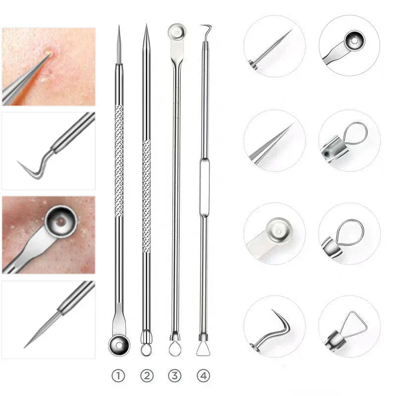 Stainless Steel Blackhead Comedone Acne Blemish Extractor