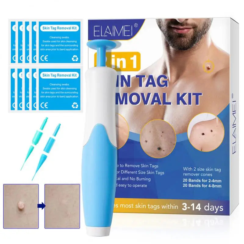 Painless Auto Skin Tag Mole Wart