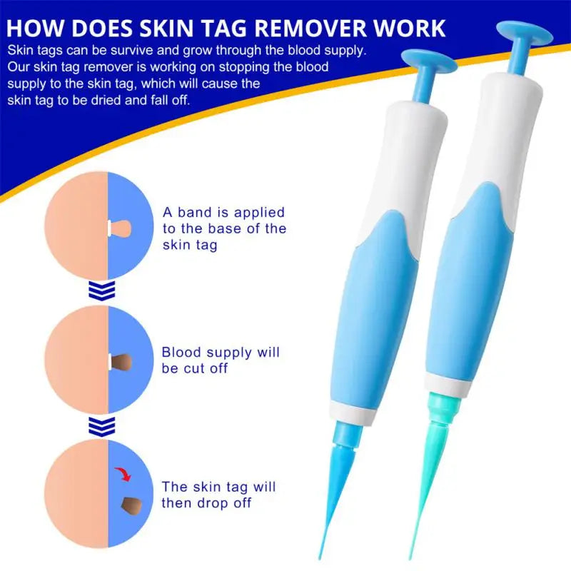 Painless Auto Skin Tag Mole Wart
