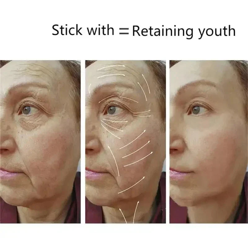 Upgrade Radio Frequency Machine Rf Facial Beauty Device