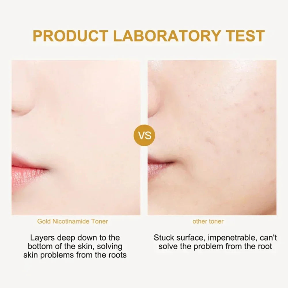Face Gold Nicotinamide Toner Moisturize Oil