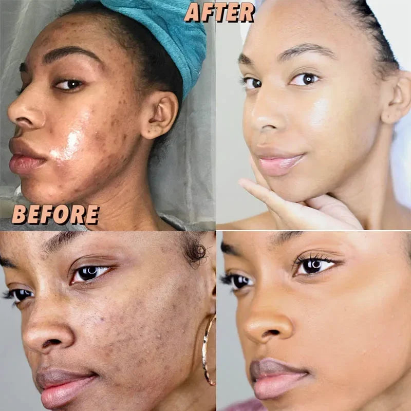 Turmeric Soaps Natural Handmade Soap Clean