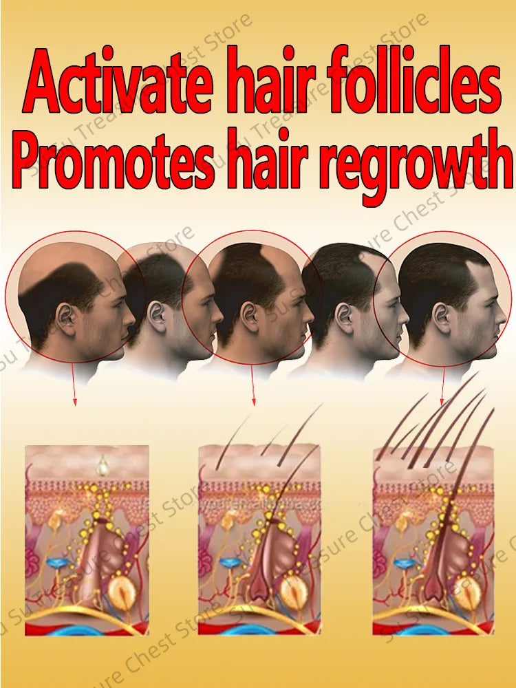 Hair Growth Oil Baldness For Men Treatment