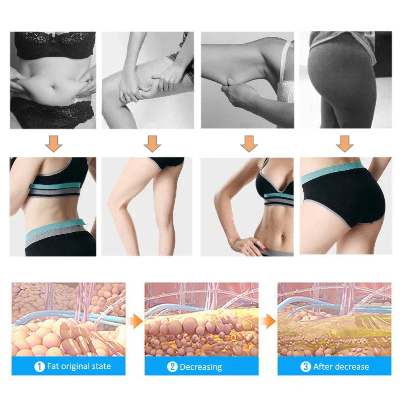 Anti Cellulite Massager Electric Full Body Slimming Massager