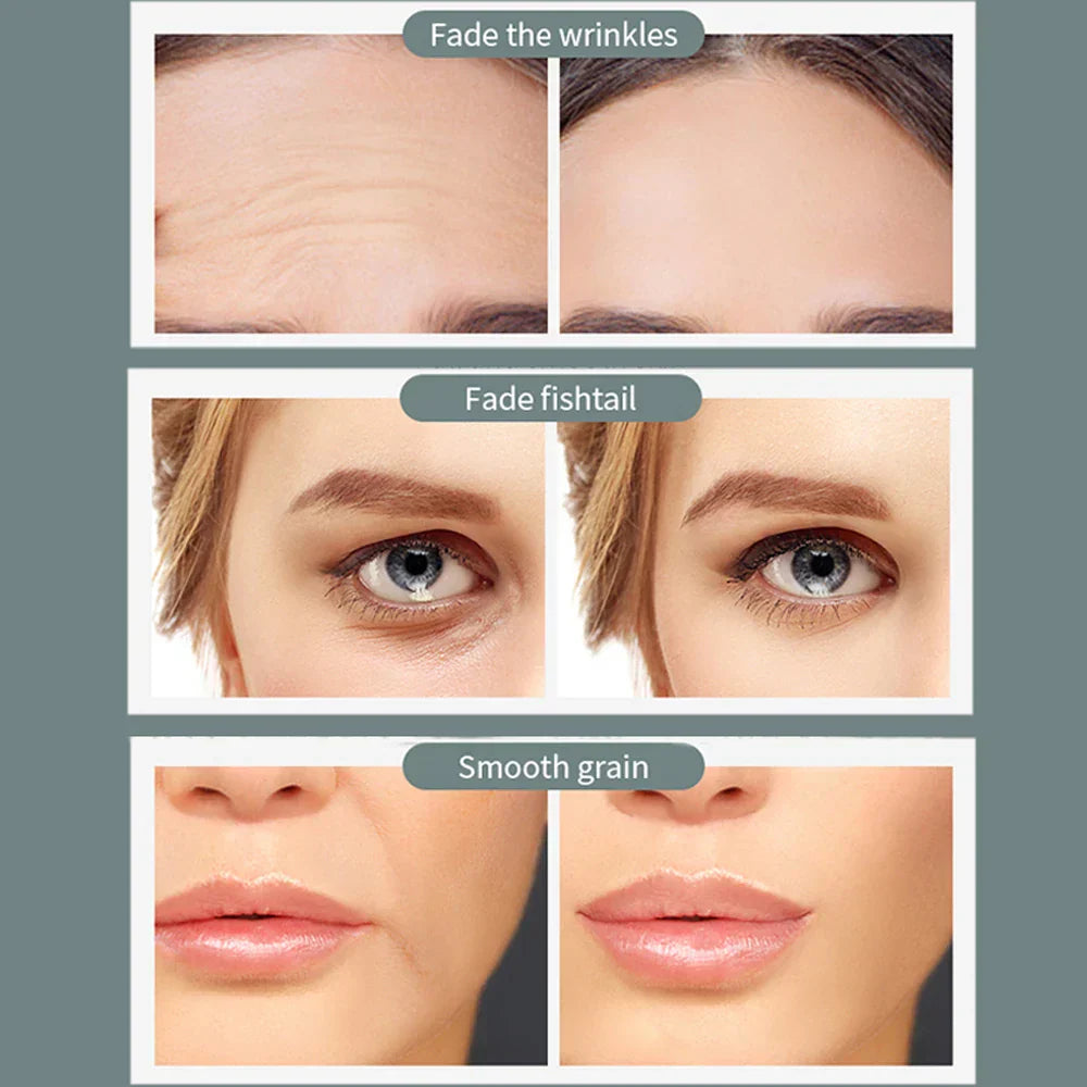 Ems Wirelss D Roller Face Lifting Massager Micro-Current