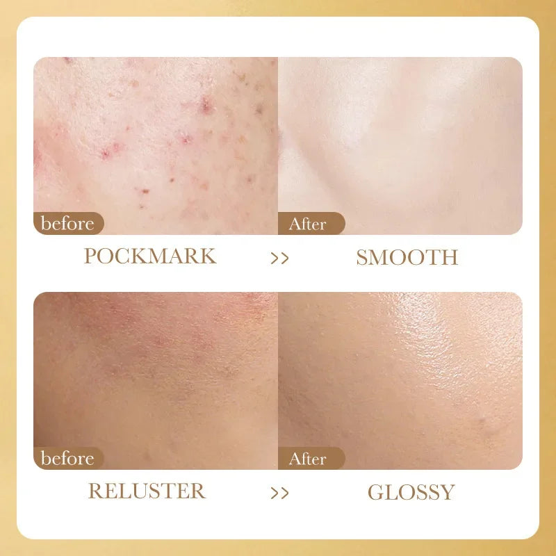 Face Serum Niacinamide Whitening Freeze-Dried Podwer Shrink