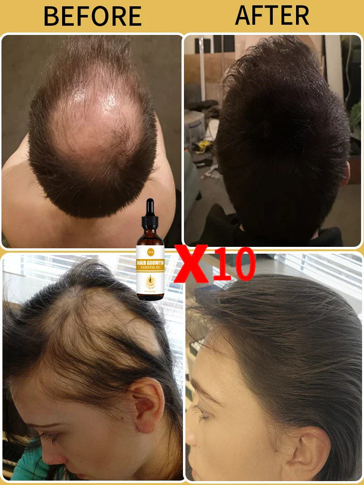 Fast Hair Growth Oil For Men Treatment