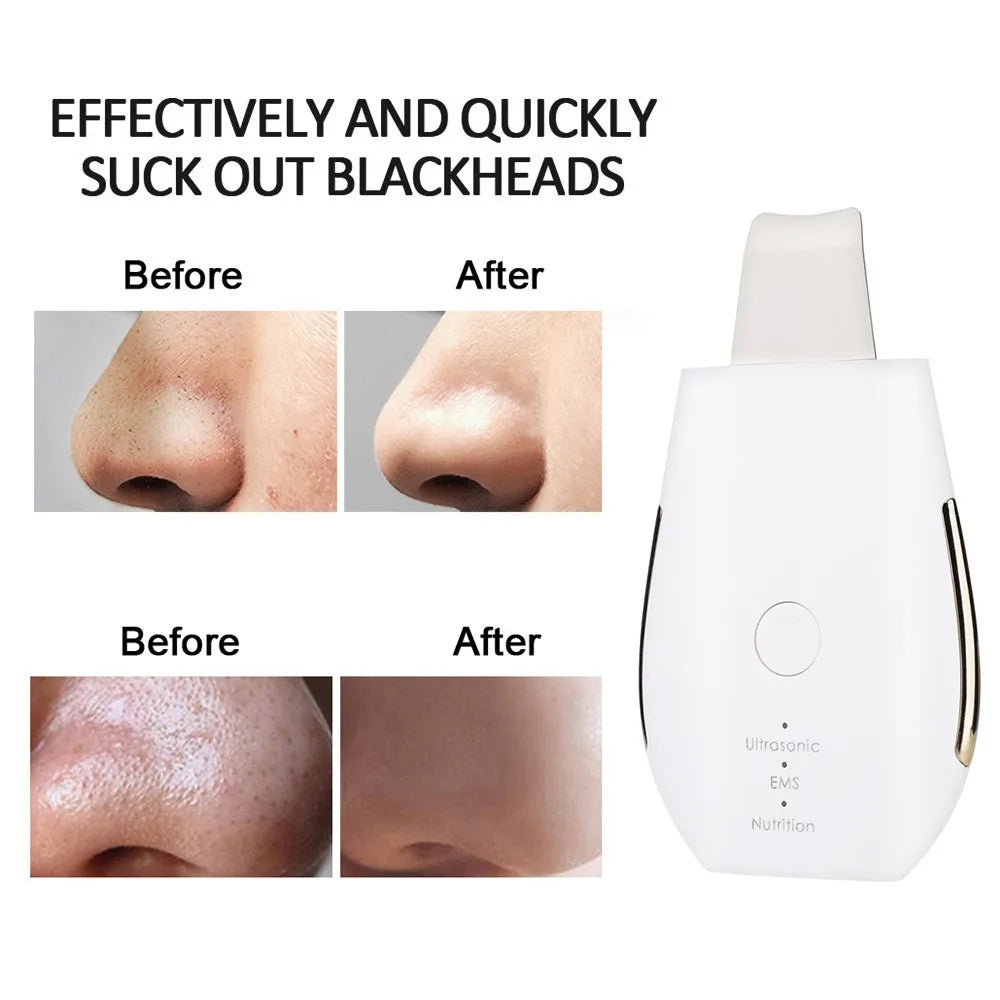 Rechargeable Ultrasonic Face Skin Scrubber Facial Cleaner Peeling