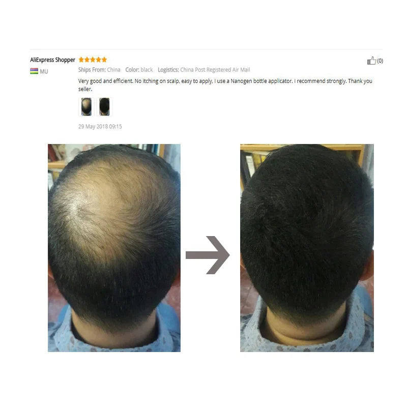 Hair Loss Product One Kit Hair Building Fiber