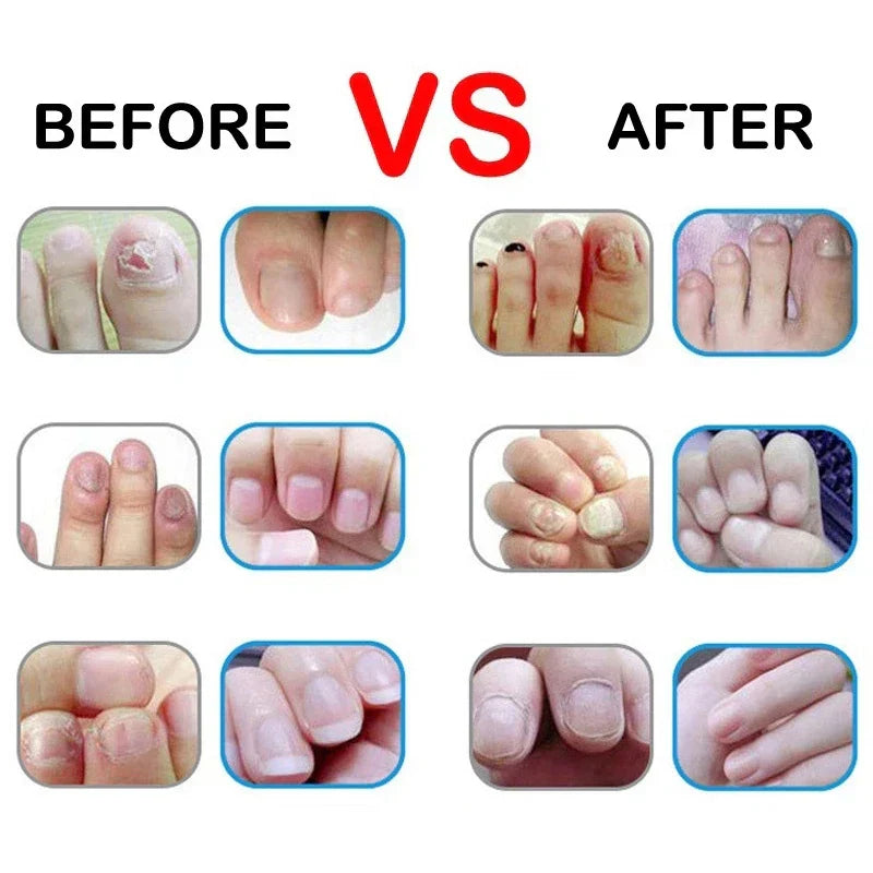 Smells Nail Nutrition Oil Pen Nail Treatment Cuticle