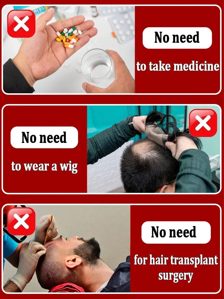 Hair Growth Oil,Effective Baldness Repair, Hereditary Hair Loss,