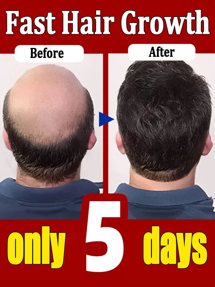 Hair Growth Products Fast Hair Growth Hair Growth