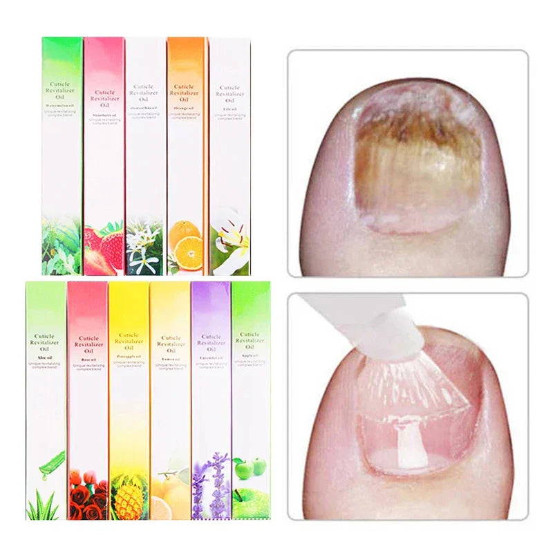 Smells Nail Nutrition Oil Pen Nail Treatment Cuticle