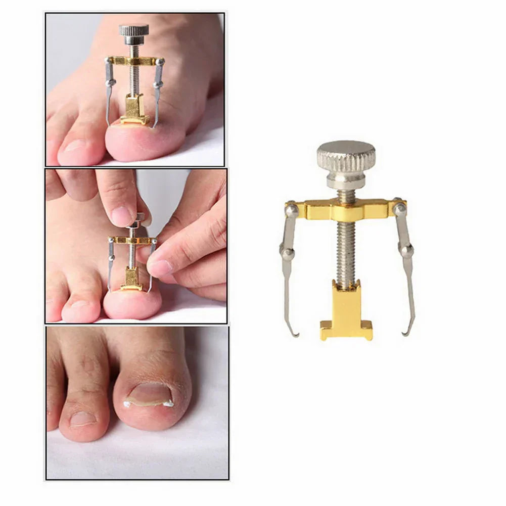 Ingrown Nail Recover Pedicure Tool Fixer Nail Curly