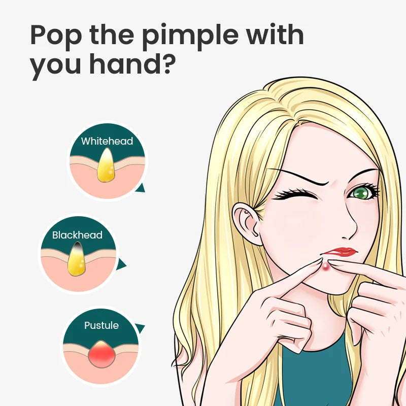 Mr.Green Blackhead Remover Acne Removal Needle Professional Pimple