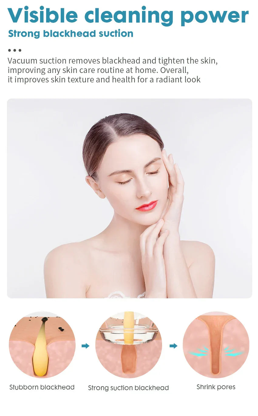 Notime Facial Pore Cleaner Electric Blackhead Remover Tool