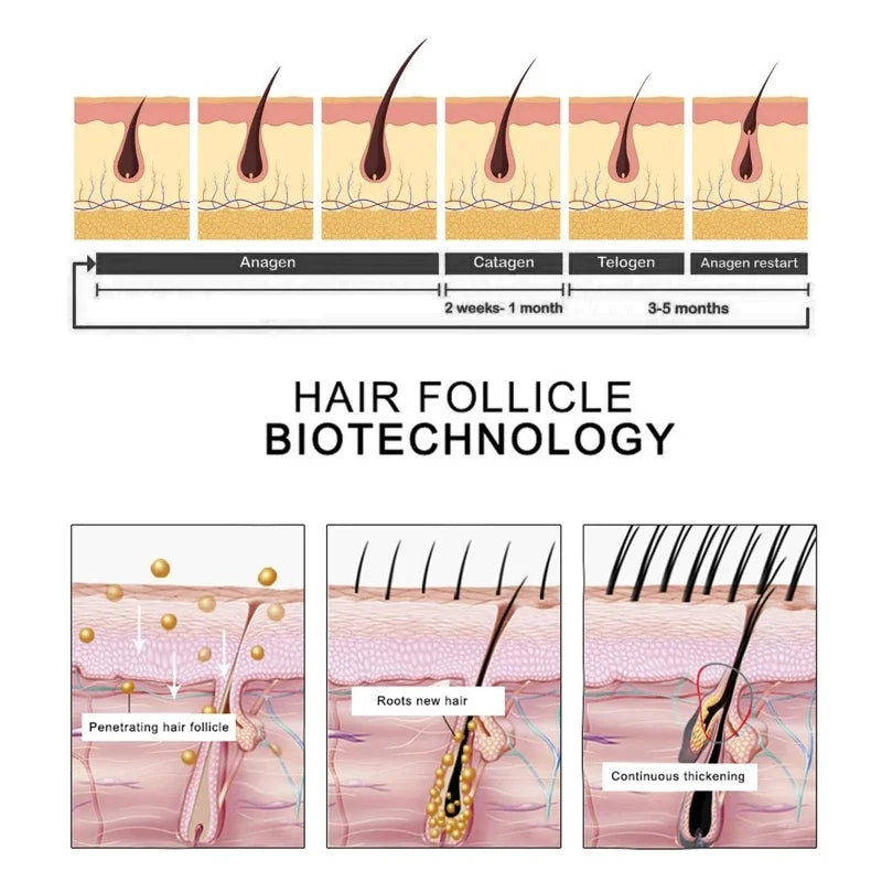 Natural Ginger Hair Growth Spray Hair Roots Fast