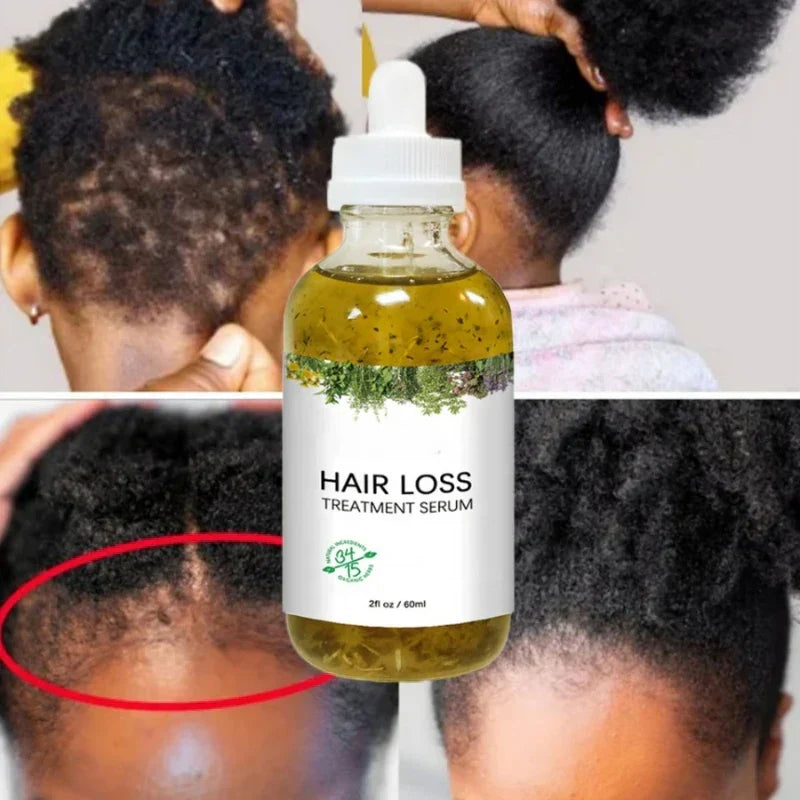 New Fast Hair Growth Serum % African Crazy