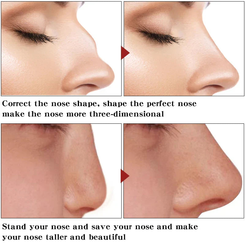 Nose Up Heighten Rhinoplasty Oil Nose Up