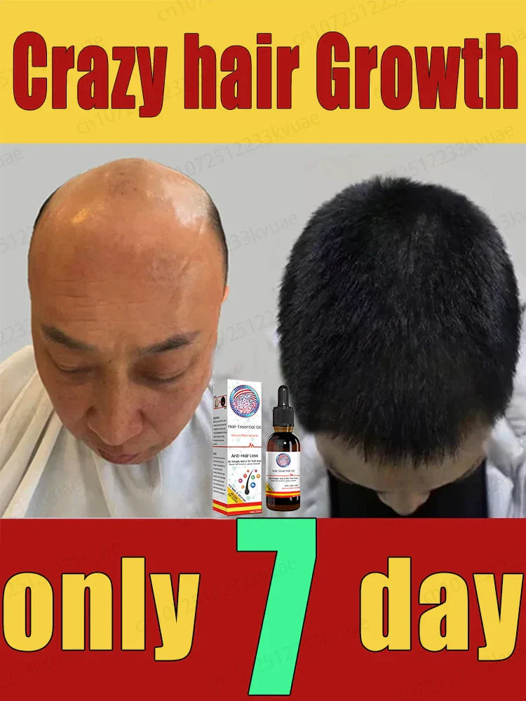 Oil Hair Growth Products For Man Women Ginger