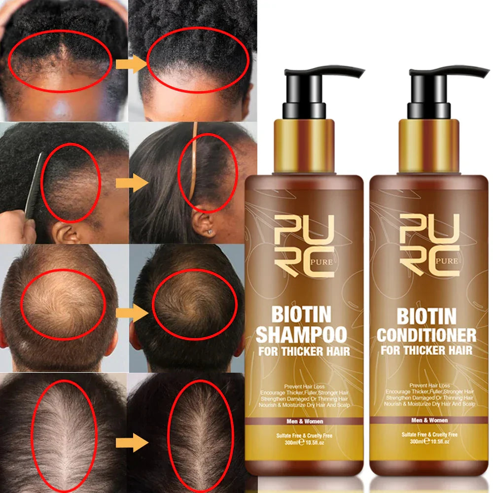 Purc Fast Hair Growth Products For Men Biotin