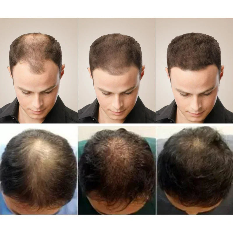 Ginger Hair Growth Soap Anti Hair Loss Fast