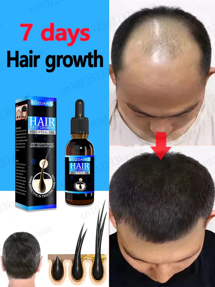Hair Growth Essence Can Quickly Grow Hair