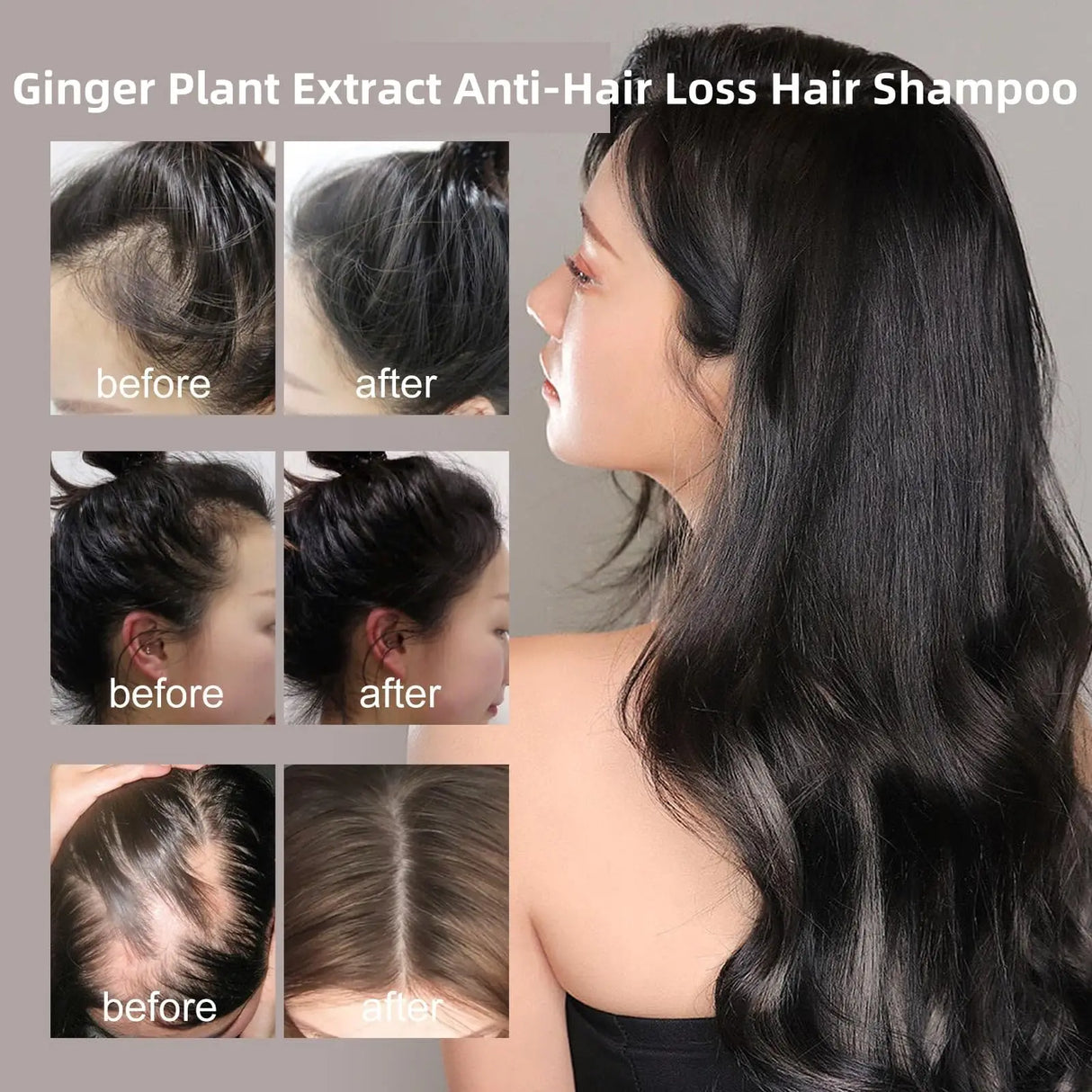 Ginger Plant Extract Anti-Hair Loss Hair Shampoo Polygonum