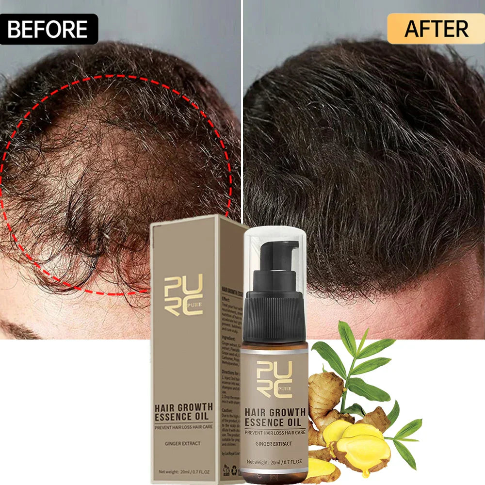 Purc Hair Growth Oil For Men Women Anti