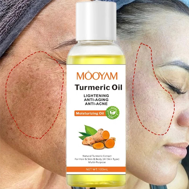 Turmeric Oil Face Whitening Lightening Acne Dark Patches
