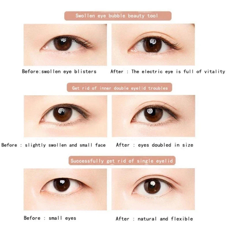 Unny Eyelid Tape Sticker Invisible Double Fold Eyelid
