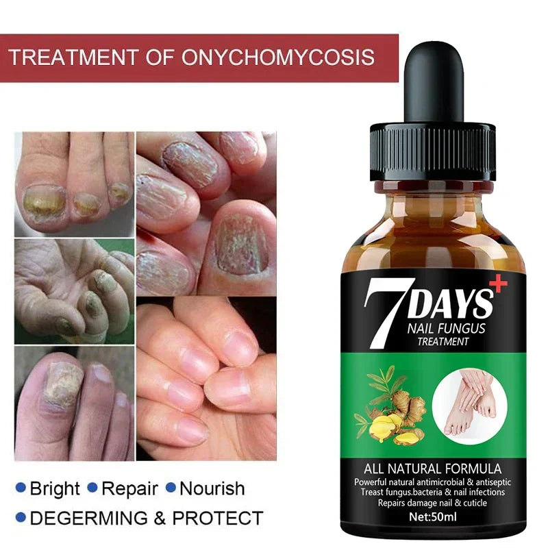 Days Repair Nail Fungus Treatments Essence Foot Care
