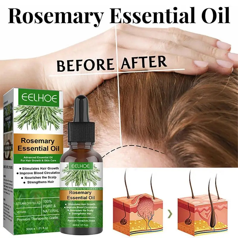Rosemary Oil For Hair Growth Anti Hairs Loss