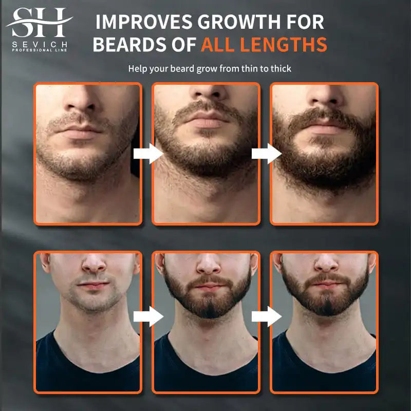 New Chebe Beard Growth Oil For Men Fast