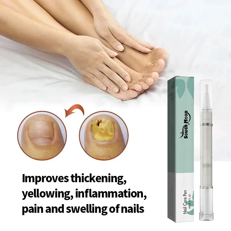 Nail Treatment Pen Anti Fungal Nail Ingrown Cream