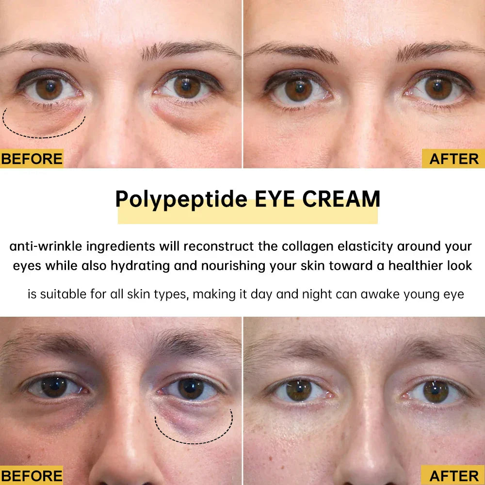 Eye Cream Eye Bags Removal Under