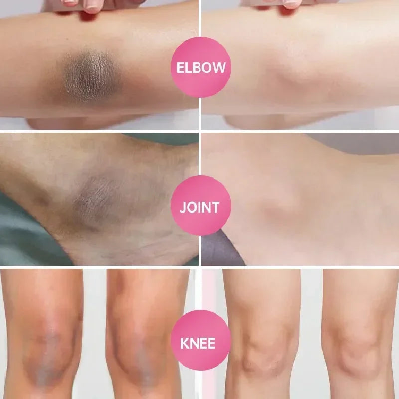 Effective Improve Body Whitening Cream Armpit Legs Knee
