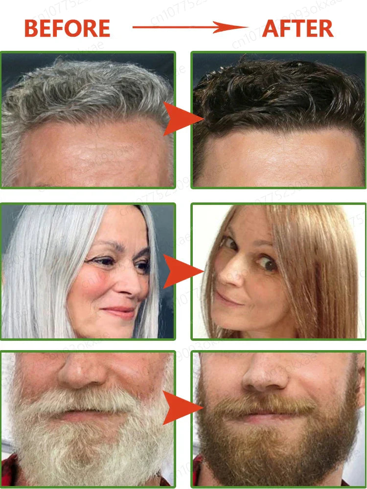 Anti-Grey Hair Essence, Restore Natural Hair Color And