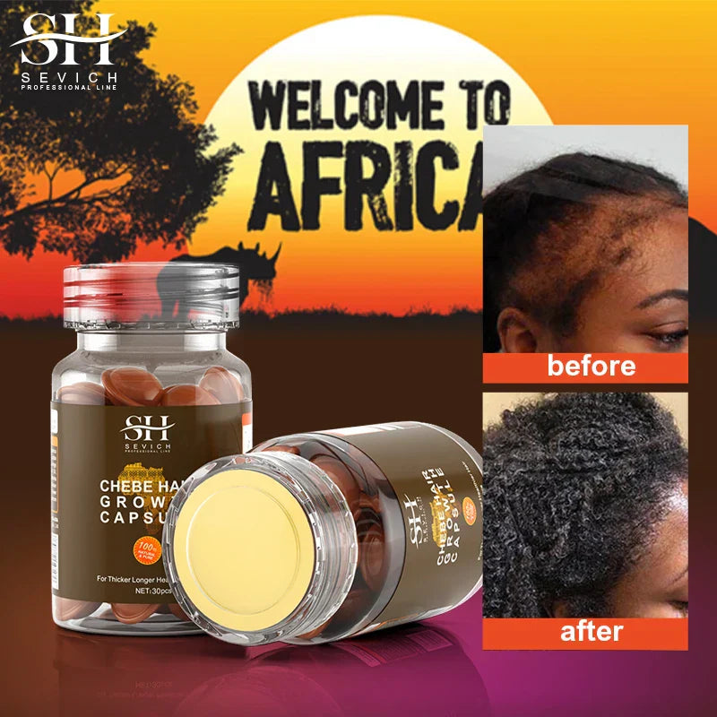 Hot Sale Chebe Hair Growth Oil Capsules African