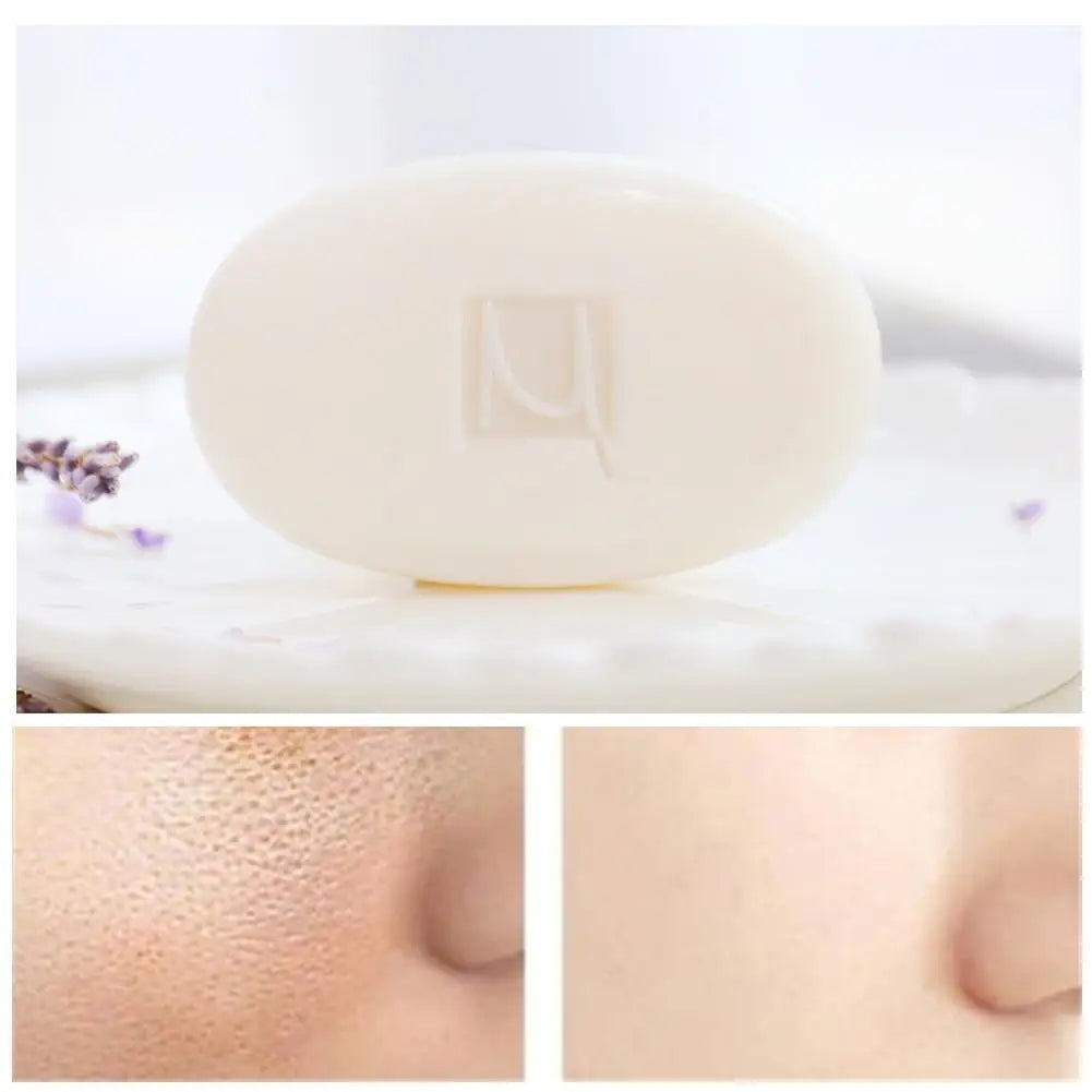 Manting Mites Acarus Acari Removing Body Face