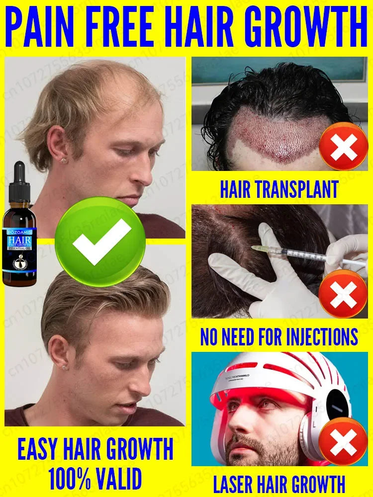 Hair Growth Essence Can Quickly Grow Hair