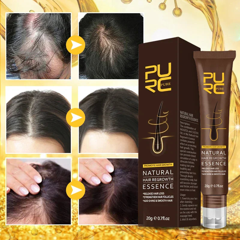 Purc Fast Hair Growth For Men Women Anti