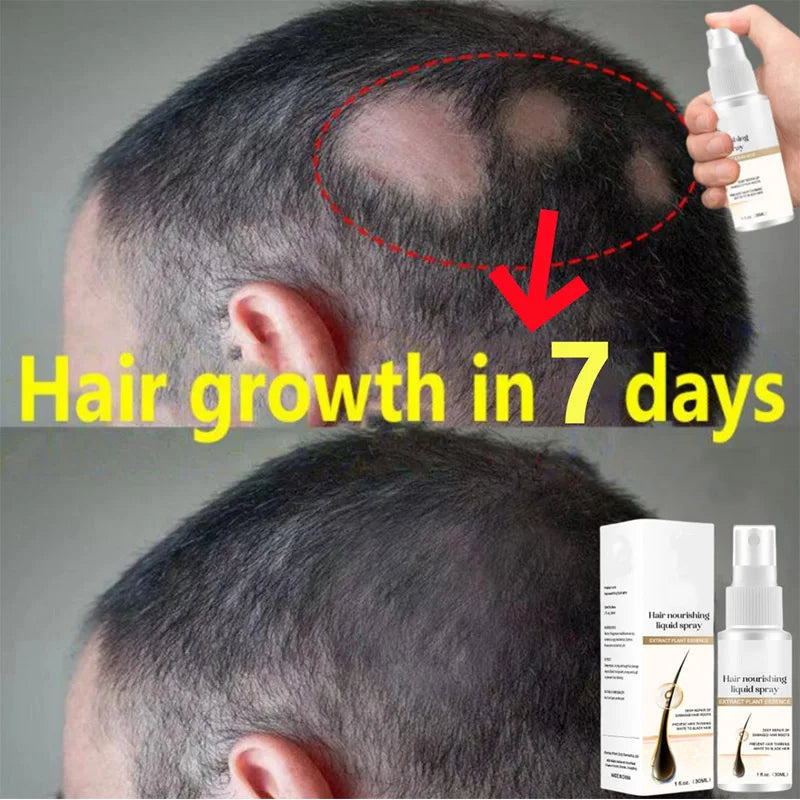 Ginger Hair Growth Spray Promote Fast Thicker Longer