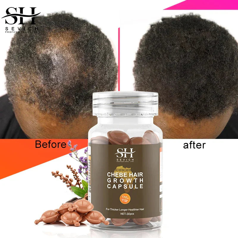 Hot Sale Chebe Hair Growth Oil Capsules African