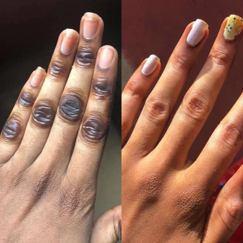 Get Rid Of Dark Knuckles In Days