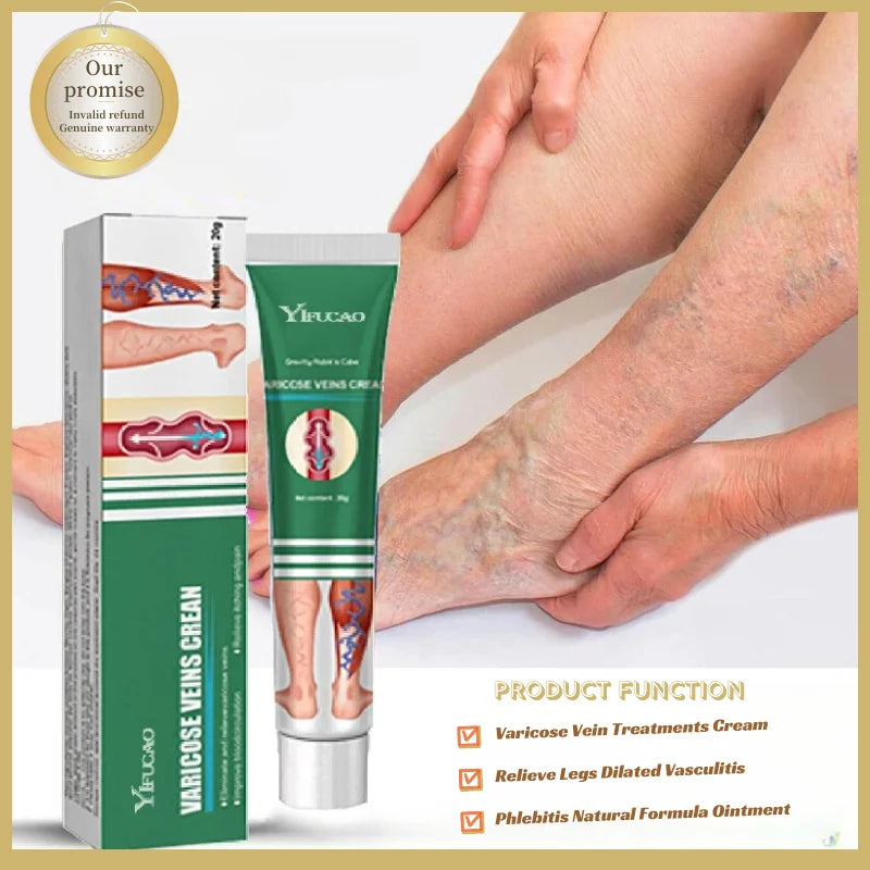 Varicose Vein Treatments Cream Effective Relieve Legs Dilated