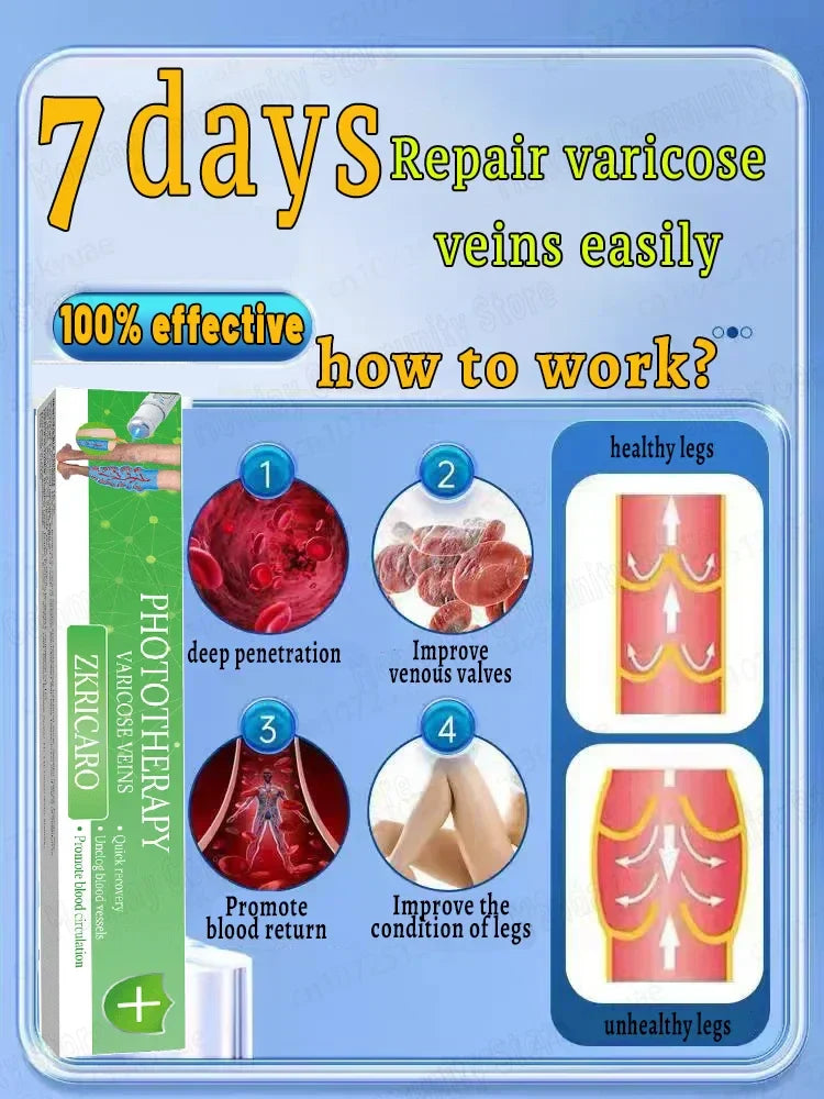 Powerful Laser Therapy For Moderate Varicose Veins, Relieve