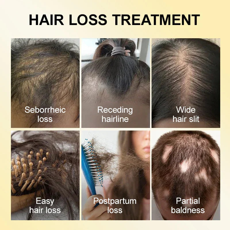 Purc Hair Growth For Men Women Products Ginger