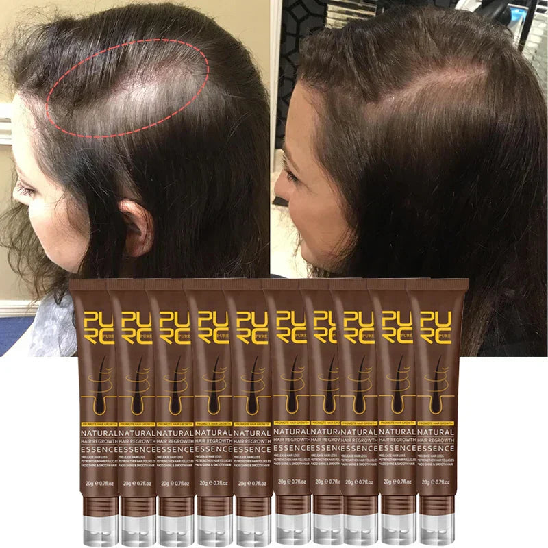 Purc Fast Hair Growth For Men Women Anti